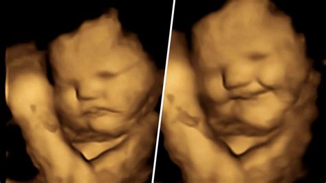6 aylık bebek görüntüsü anne karnında
